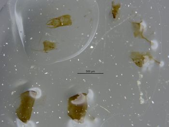 Media type: image;   Entomology 6571 Aspect: body parts